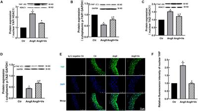 Activation of Yes-Associated Protein/PDZ-Binding Motif Pathway Contributes to Endothelial Dysfunction and Vascular Inflammation in AngiotensinII Hypertension